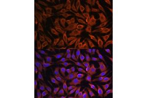 Immunofluorescence (IF) image for anti-GIT1 (GIT1) (AA 460-640) antibody (ABIN7267383)