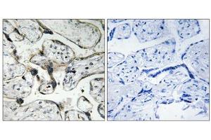 Immunohistochemistry analysis of paraffin-embedded human placenta tissue using PAK1/2 (epitope around residue 199) antibody. (PAK1/2 Antikörper  (Ser199))