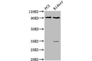 Western Blot Positive WB detected in: PC-3 whole cell lysate, Rat kidney tissue All lanes: CDK11A antibody at 4 μg/mL Secondary Goat polyclonal to rabbit IgG at 1/50000 dilution Predicted band size: 92, 91, 46, 19, 63, 50 kDa Observed band size: 92 kDa (Cyclin-Dependent Kinase 11A (CDK11A) (AA 5-216) Antikörper)