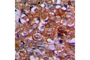 Immunohistochemistry (IHC) image for anti-Ephrin Type A Receptor 1 (EPHA1) antibody (ABIN7303062)