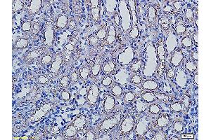 Formalin-fixed and paraffin embedded rat kidney labeled with Anti-AQP5 Polyclonal Antibody, Unconjugated (ABIN731258) followed by conjugation to the secondary antibody and DAB staining