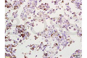 Immunohistochemistry (IHC) image for anti-Melanoma Antigen Family A, 1 (Directs Expression of Antigen MZ2-E) (MAGEA1) (AA 101-200) antibody (ABIN728578)