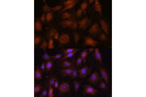 Immunofluorescence analysis of C6 cells using NOB1 antibody (ABIN7270109) at dilution of 1:100.