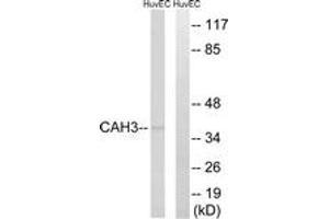 Western Blotting (WB) image for anti-Carbonic Anhydrase III (CA3) (AA 141-190) antibody (ABIN2890188) (CA3 Antikörper  (AA 141-190))