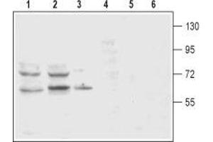 Western blot analysis of rat (lanes 1 and 4) and mouse (lanes 2 and 5) brain membranes and rat pheochromocytoma PC12 (lanes 3 and 6) cell lysates: - 1-3. (SLC6A3 Antikörper  (2nd Extracellular Loop))