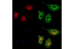 ABIN6261174 and ABIN6273223 staining HUVEC cells by IF/ICC.