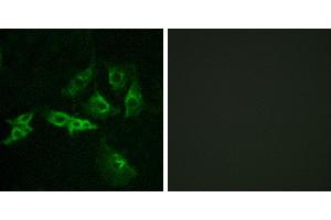 Peptide - +Immunofluorescence analysis of A549 cells, using GNRHR antibody.