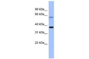 MAGEB1 antibody used at 1 ug/ml to detect target protein. (MAGEB1 Antikörper  (Middle Region))