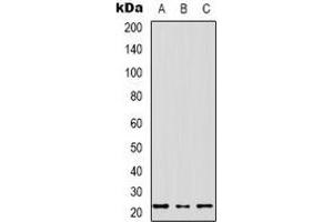 Western blot analysis of MRPS17 expression in SHSY5Y (A), HEK293T (B), NIH3T3 (C) whole cell lysates. (MRPS17 Antikörper  (N-Term))