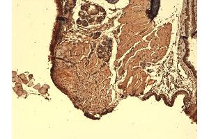 Immunohistochemistry analysis using Mouse Anti-Sodium Iodide Symporter Monoclonal Antibody, Clone 14F .