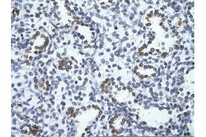 Rabbit Anti-PHF17 Antibody       Paraffin Embedded Tissue:  Human alveolar cell   Cellular Data:  Epithelial cells of renal tubule  Antibody Concentration:   4.