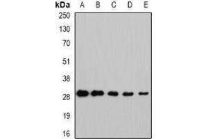 Western blot analysis of NNMT expression in Hela (A), HepG2 (B), mouse brain (C), rat lung (D), rat liver (E) whole cell lysates. (NNMT Antikörper)