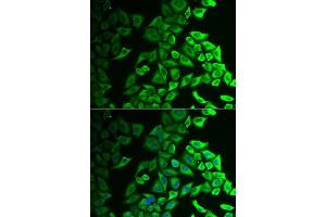 Immunofluorescence analysis of A549 cells using IL18BP antibody. (IL18BP Antikörper  (AA 31-194))