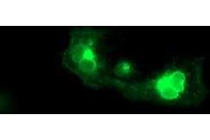 Anti-FGFR2 mouse monoclonal antibody (ABIN2454751) immunofluorescent staining of COS7 cells transiently transfected by pCMV6-ENTRY FGFR2 (RC217098). (FGFR2 Antikörper)