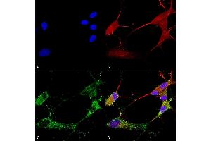 Immunocytochemistry/Immunofluorescence analysis using Mouse Anti-TARP Gamma2/4/8 (Stargazin) Monoclonal Antibody, Clone S245-36 (ABIN2483285). (Stargazin Antikörper  (AA 203-323) (FITC))