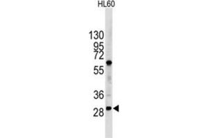Western Blotting (WB) image for anti-Lin-28 Homolog B (LIN28B) antibody (ABIN2998297) (LIN28B Antikörper)