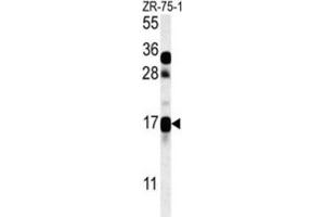 Western Blotting (WB) image for anti-CSAG Family, Member 2 (CSAG2) antibody (ABIN3002341)