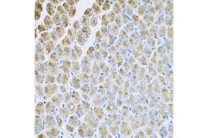 Immunohistochemistry of paraffin-embedded mouse stomach using AP1M2 antibody (ABIN5974667) at dilution of 1/100 (40x lens). (AP1m2 Antikörper)