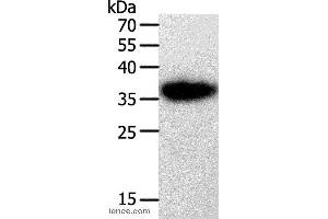 Western blot analysis of A549 cell, using PLAUR Polyclonal Antibody at dilution of 1:450 (PLAUR Antikörper)
