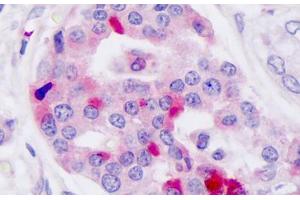 Anti-GLP-1 Receptor / GLP1R antibody IHC staining of human pancreas, islet of langerhans. (GLP1R Antikörper  (N-Term))