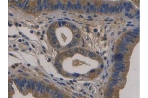 Detection of FBLN1 in Mouse Uterus Tissue using Monoclonal Antibody to Fibulin 1 (FBLN1) (Fibulin 1 Antikörper  (AA 399-578))