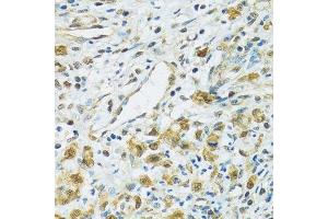 Immunohistochemistry (Paraffin-embedded Sections) (IHC (p)) image for anti-Ribosomal Protein S7 (RPS7) (AA 1-194) antibody (ABIN6147244)