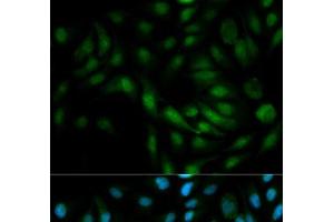 Immunofluorescence analysis of MCF-7 cells using MAPK7 Polyclonal Antibody (MAPK7 Antikörper)