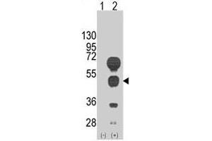 Western blot analysis of GATA4 (arrow) using rabbit GATA4 polyclonal antibody . (GATA4 Antikörper  (C-Term))
