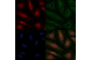ABIN6259171 and ABIN6275708 staining  cells by IF/ICC. (RAD51C Antikörper  (Internal Region))