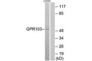 Western blot analysis of extracts from LOVO cells, using GPR103 Antibody. (QRFPR Antikörper  (AA 271-320))