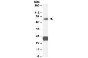 Western blot testing of human cerebellum lysate with FOXP2 antibody at 0. (FOXP2 Antikörper)