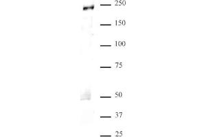 MED1 antibody (pAb) tested by Immunoprecipitation. (MED1 Antikörper  (C-Term))