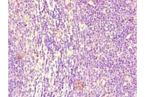 Immunohistochemistry (IHC) image for anti-Fc Fragment of IgG, Low Affinity IIb, Receptor (CD32) (FCGR2B) (AA 12-289) antibody (ABIN7158541)