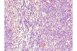 Immunohistochemistry of paraffin-embedded human lymph node tissue using ABIN7158541 at dilution of 1:100 (FCGR2B Antikörper  (AA 12-289))