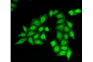 Immunofluorescence analysis of HeLa cells using SSRP1 antibody (ABIN6129536, ABIN6148492, ABIN6148494 and ABIN6217711). (SSRP1 Antikörper  (AA 1-300))