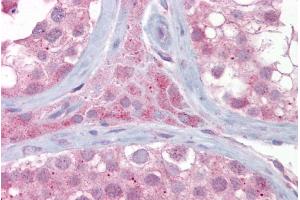 Immunohistochemistry with Testis tissue at an antibody concentration of 5µg/ml using anti-UBE2L3 antibody (ARP43023_P050) (UBE2L3 Antikörper  (Middle Region))