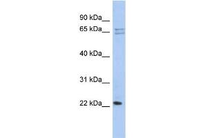 WB Suggested Anti-RPL18 Antibody Titration: 0. (RPL18 Antikörper  (N-Term))