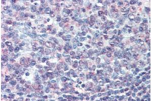 Anti-CD70 antibody  ABIN960751 IHC staining of human tonsil. (CD70 Antikörper  (N-Term))