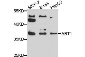 Western blot analysis of extracts of various cells, using ART1 antibody. (ART1 Antikörper)