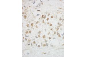 anti-UTP6, Small Subunit (SSU) Processome Component, Homolog (UTP6) (AA 565-597) antibody