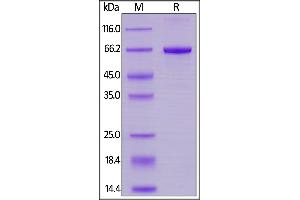 Cynomolgus SIRP alpha, His Tag on  under reducing (R) condition.