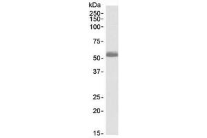 Western blot testing of human heart lysate with ADRB1 antibody at 0.