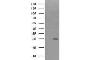 Image no. 1 for anti-Fibronectin Type III Domain Containing 4 (FNDC4) antibody (ABIN1498288)