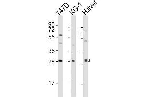 Western Blot at 1:2000 dilution Lane 1: T47D whole cell lysates Lane 2: KG-1 whole cell lysates Lane 3: human liver lysates Lysates/proteins at 20 ug per lane. (TIM3 Antikörper  (AA 167-194))
