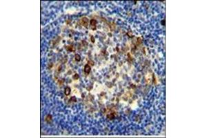 Immunohistochemistry analysis in Formalin Fixed, Paraffin Embedded Human tonsil tissue using RPS6 antibody (Ser240/244) followed by peroxidase conjugation of the secondary antibody and DAB staining. (RPS6 Antikörper  (AA 227-257))