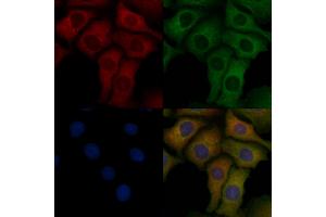 ABIN6258288 and ABIN6275675 staining Hela cells by IF/ICC.