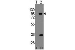 Image no. 2 for anti-Prospero Homeobox 1 (PROX1) (Center) antibody (ABIN357418) (PROX1 Antikörper  (Center))