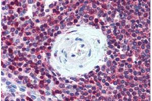 Human Spleen (formalin-fixed, paraffin-embedded) stained with SLC9A3R1 antibody ABIN305897 at 5 ug/ml followed by biotinylated goat anti-rabbit IgG secondary antibody ABIN481713, alkaline phosphatase-streptavidin and chromogen. (SLC9A3R1 Antikörper)