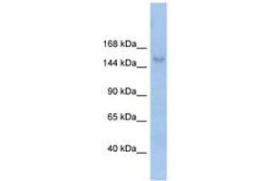 Image no. 1 for anti-Mov10l1, Moloney Leukemia Virus 10-Like 1 (MOV10L1) (AA 71-120) antibody (ABIN6742690) (MOV10L1 Antikörper  (AA 71-120))