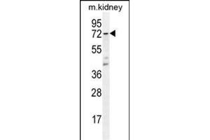 CYP5A1 Antibody (Center) (ABIN656016 and ABIN2845391) western blot analysis in mouse kidney tissue lysates (35 μg/lane). (TBXAS1 Antikörper  (AA 226-257))